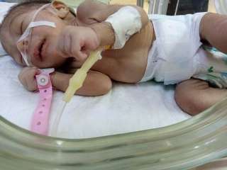 رئيس جامعة أسيوط :نجاح عملية...