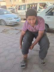 يعانى من غرغرينة فى الرجل...