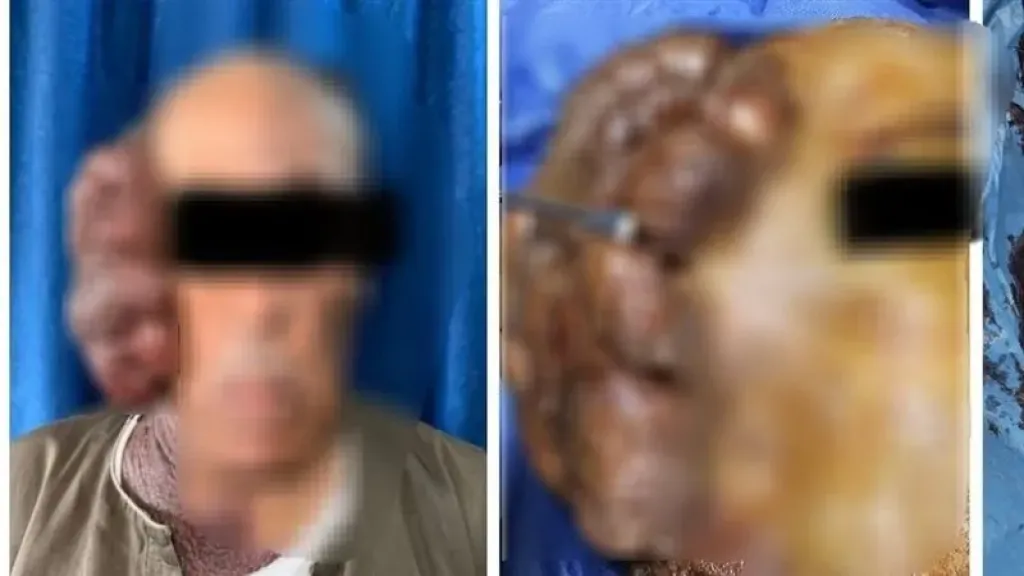 جراحة نادرة