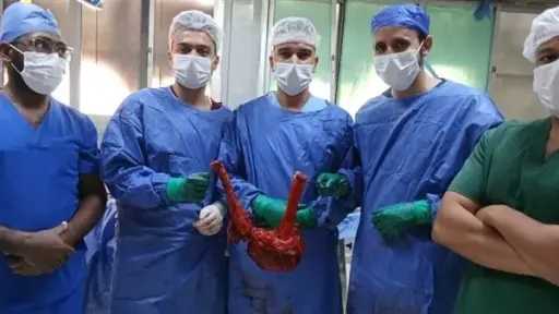 فريق طبي ينجج في استئصال...