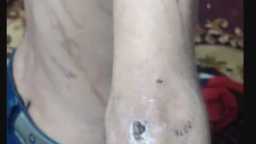 جحيم زوجة أب.. ضرب وحبس...